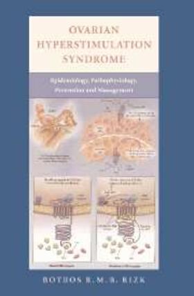 Rizk |  Ovarian Hyperstimulation Syndrome | eBook | Sack Fachmedien