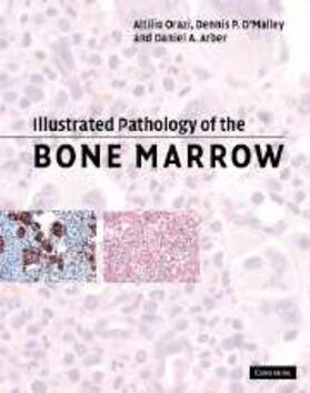 Orazi |  Illustrated Pathology of the Bone Marrow | eBook | Sack Fachmedien