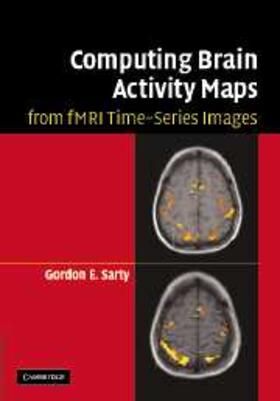 Sarty |  Computing Brain Activity Maps from fMRI Time-Series Images | eBook | Sack Fachmedien