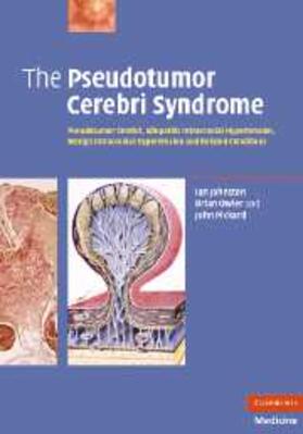 Johnston |  Pseudotumor Cerebri Syndrome | eBook | Sack Fachmedien