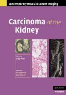 Patel |  Carcinoma of the Kidney | eBook | Sack Fachmedien