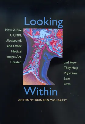 Wolbarst |  Looking Within - How X-Ray, CT, MRI, Ultrasound, &  Other Medical Images are Created & How they Help Physician | Buch |  Sack Fachmedien