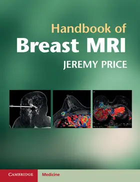 Price |  Handbook of Breast MRI | Buch |  Sack Fachmedien