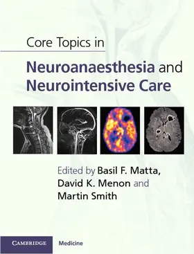 Matta / Menon / Smith | Core Topics in Neuroanaesthesia and Neurointensive Care | Buch | 978-0-521-19057-2 | www.sack.de