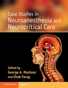 Mashour / Farag | Case Studies in Neuroanesthesia and Neurocritical Care | Buch | 978-0-521-19380-1 | www.sack.de