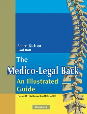 Dickson / Butt |  The Medico-Legal Back | Buch |  Sack Fachmedien