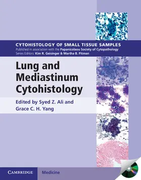 Ali / Yang |  Lung and Mediastinum Cytohistology | Buch |  Sack Fachmedien