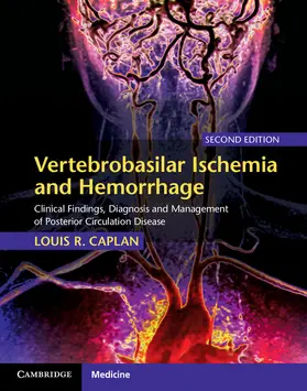 Caplan | Vertebrobasilar Ischemia and Hemorrhage | Buch | 978-0-521-76306-6 | www.sack.de