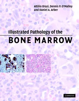 Orazi / O'Malley / Arber |  Illustrated Pathology of the Bone Marrow | Buch |  Sack Fachmedien