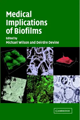 Wilson / Devine |  Medical Implications of Biofilms | Buch |  Sack Fachmedien