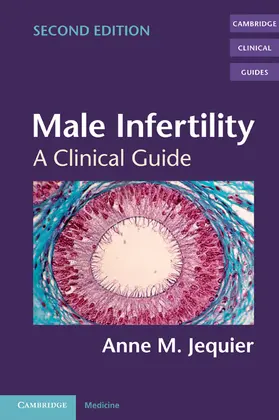 Jequier |  Male Infertility | Buch |  Sack Fachmedien
