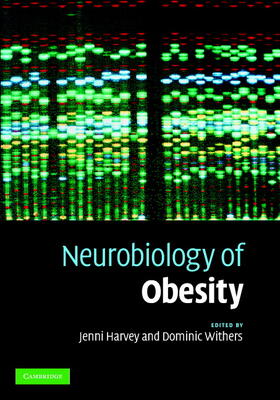 Harvey / Withers | Neurobiology of Obesity | Buch | 978-0-521-86033-8 | sack.de
