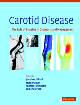 Gillard / Graves / Hatsukami |  Carotid Disease | Buch |  Sack Fachmedien