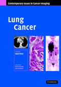 Desai |  Lung Cancer | Buch |  Sack Fachmedien