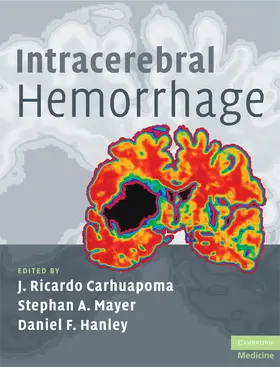 Carhuapoma / Mayer / Hanley |  Intracerebral Hemorrhage | Buch |  Sack Fachmedien