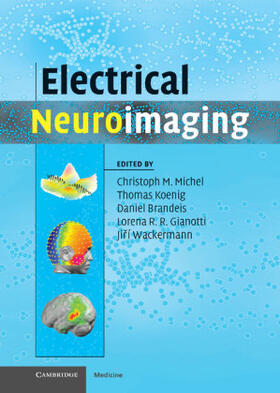 Miche / Koenig / Michel | Electrical Neuroimaging | Buch | 978-0-521-87979-8 | sack.de