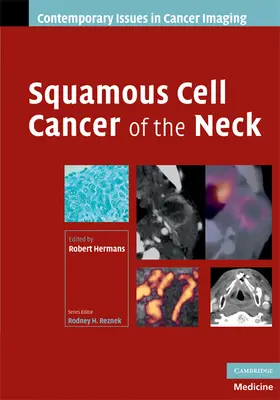 Hermans |  Squamous Cell Cancer of the Neck | Buch |  Sack Fachmedien