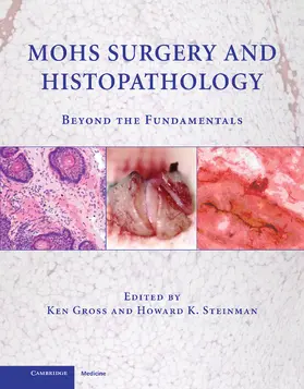 Gross / Steinman |  Mohs Surgery and Histopathology | Buch |  Sack Fachmedien
