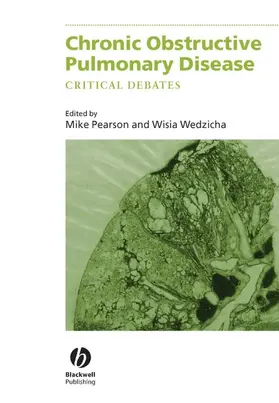 Pearson / Wedzicha |  Chronic Obstructive Pulmonary Disease | Buch |  Sack Fachmedien