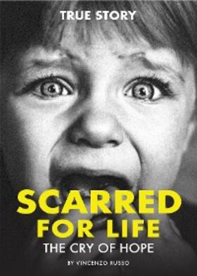 Russo |  SCARRED FOR LIFE | eBook | Sack Fachmedien