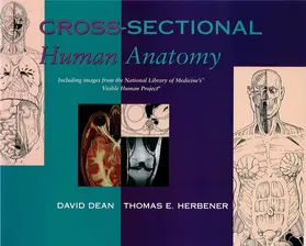 Dean / Herbener |  Cross-Sectional Human Anatomy | Buch |  Sack Fachmedien