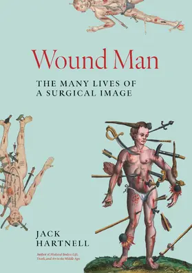 Hartnell |  Wound Man | eBook | Sack Fachmedien
