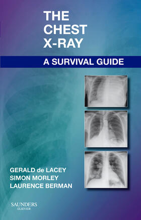 de Lacey / Berman / Morley | The Chest X-Ray: A Survival Guide | Buch | 978-0-7020-3046-8 | sack.de