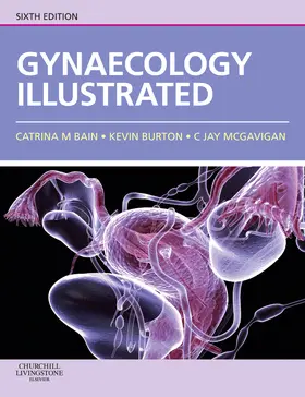 Bain / Burton / McGavigan |  Gynaecology Illustrated | Buch |  Sack Fachmedien