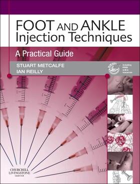 Metcalfe / Reilly | Foot and Ankle Injection Techniques | Buch | 978-0-7020-3107-6 | sack.de