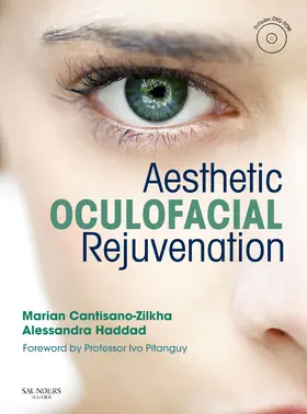 Zilkha / Haddad | Aesthetic Oculofacial Rejuvenation with DVD | Buch | 978-0-7020-3365-0 | sack.de