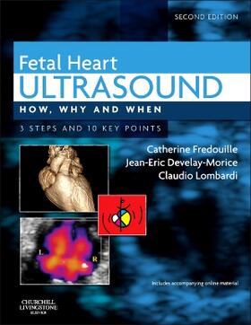 Fredouille / Develay-Morice / Lombardi |  Fetal Heart Ultrasound | Buch |  Sack Fachmedien