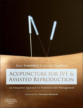 Szmelskyj / Aquilina | Acupuncture for IVF and Assisted Reproduction | Buch | sack.de