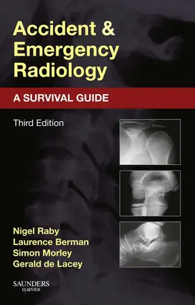 Raby / Berman / Morley |  Accident and Emergency Radiology: A Survival Guide | eBook | Sack Fachmedien