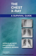 Morley / Berman |  The Chest X-Ray: A Survival Guide | eBook | Sack Fachmedien