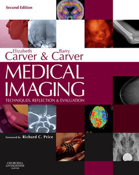 Carver | Medical Imaging - E-Book | E-Book | sack.de