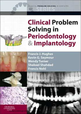 Turner BDS / Turner / Shahdad BDS |  Clinical Problem Solving in Periodontology and Implantology - E-Book | eBook | Sack Fachmedien