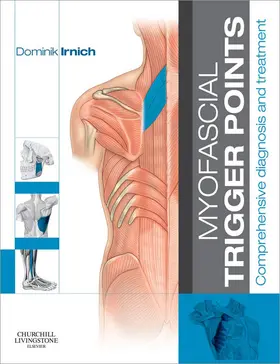 Irnich MD / Irnich |  Myofascial Trigger Points | eBook | Sack Fachmedien