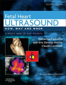 Fredouille MD / Fredouille / Develay-Morice MD |  Fetal Heart Ultrasound - E-Book | eBook | Sack Fachmedien