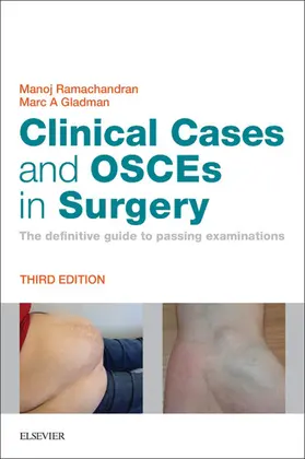 Ramachandran / Gladman |  Clinical Cases and OSCEs in Surgery E-Book | eBook | Sack Fachmedien