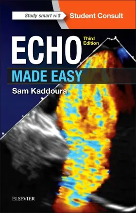 Kaddoura | Echo Made Easy | Buch | 978-0-7020-6656-6 | sack.de