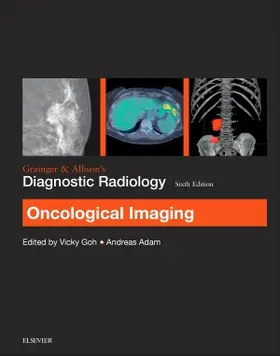 Goh / Adam |  Grainger & Allison's Diagnostic Radiology: Oncological Imaging | Buch |  Sack Fachmedien
