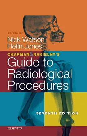 Watson / Jones |  Chapman & Nakielny's Guide to Radiological Procedures E-Book | eBook | Sack Fachmedien