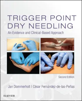 Dommerholt / Fernandez de las Penas |  Trigger Point Dry Needling | Buch |  Sack Fachmedien