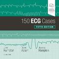 Hampton / Adlam |  150 ECG Cases | Buch |  Sack Fachmedien