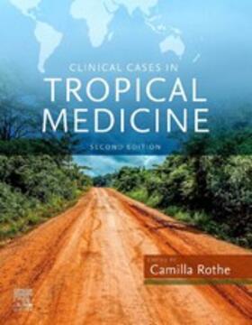 Rothe |  Clinical Cases in Tropical Medicine E-Book | eBook | Sack Fachmedien