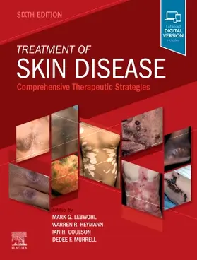 Lebwohl / Coulson / Murrell |  Treatment of Skin Disease | Buch |  Sack Fachmedien