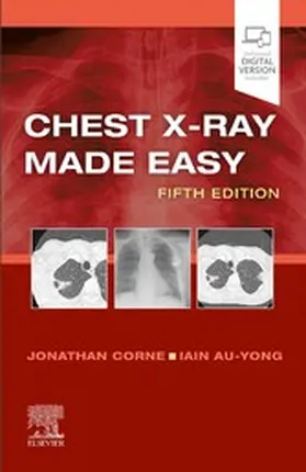 Au-Yong MA |  Chest X-Ray Made Easy E-Book | eBook | Sack Fachmedien
