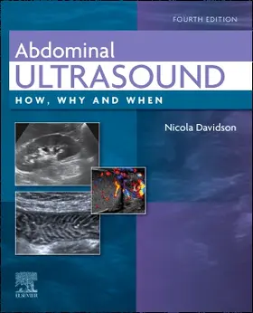 Davidson | Abdominal Ultrasound | Buch | 978-0-7020-8243-6 | sack.de