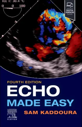 Kaddoura | Echo Made Easy | Buch | 978-0-7020-8360-0 | sack.de