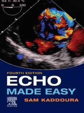 Kaddoura BSc(Hons) |  Echo Made Easy , E-Book | eBook | Sack Fachmedien